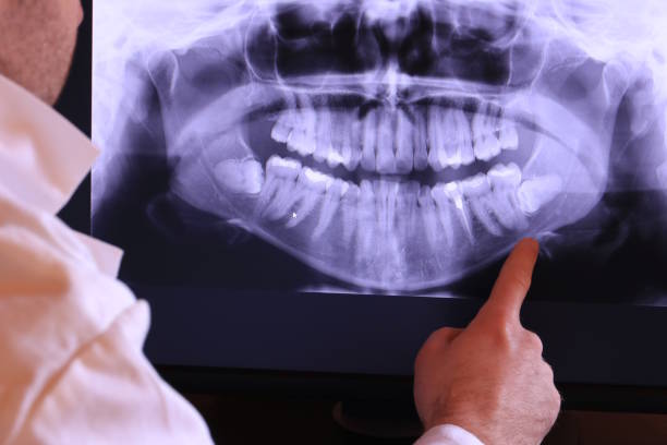 Best Emergency Dental Care for Broken or Chipped Teeth in Bridgeview, IL